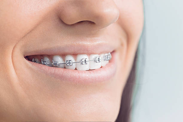 Professional Dental Services in Wolcott, IN